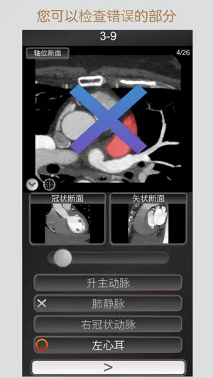 CT 护照测验 心脏 / MRI截图1